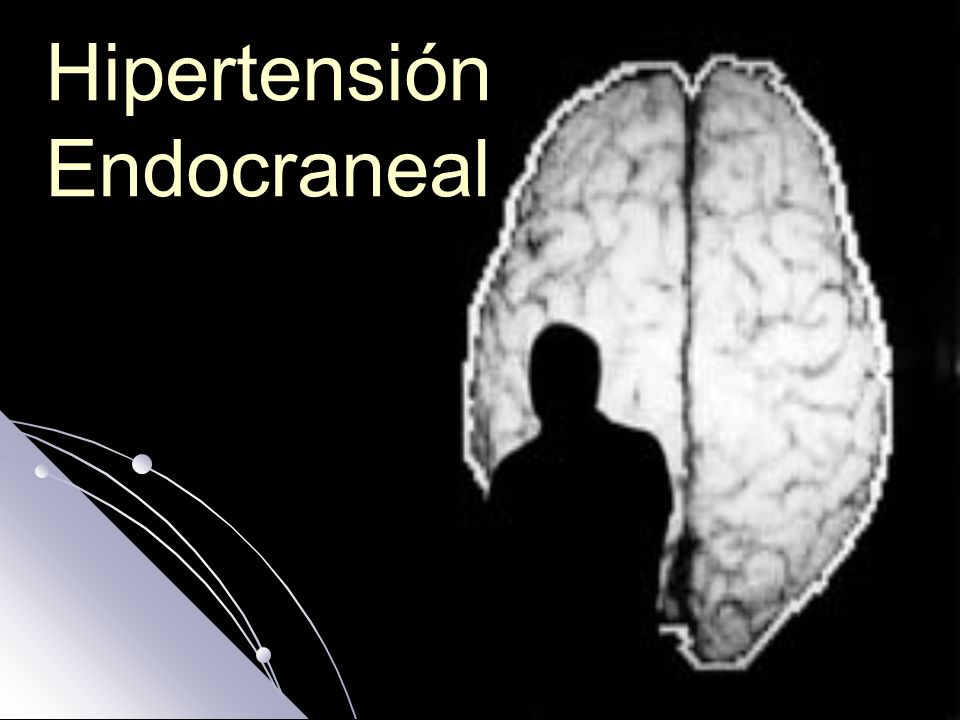 Trombosis hipertensión intracraneal